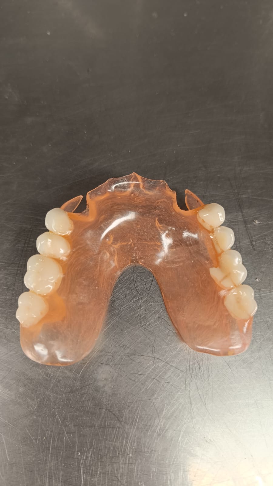 Proteza elastyczna dolna — realizacja Smile Żaneta Skoczko